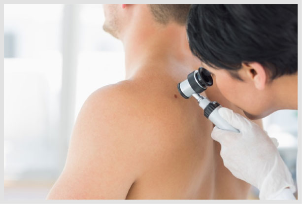 skin_cancer-checkup
